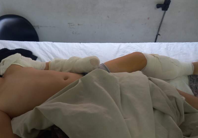 Un niño fue atacado por un perro en el barrio Atlántida