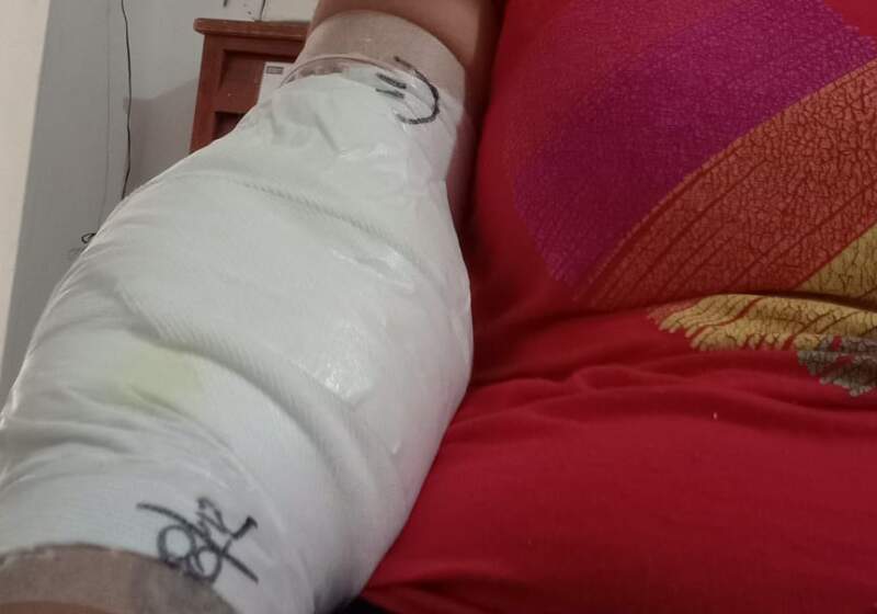 Una mujer sufrió lesiones graves tras ser mordida por un perro en Playa Dorada