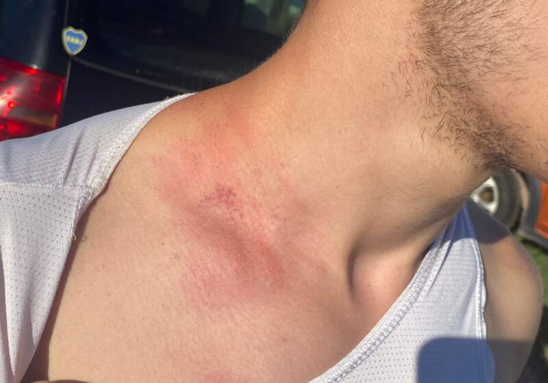 Quiso hacer justicia por mano propia y quedó imputado